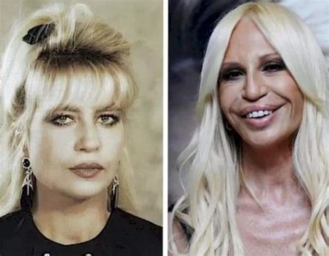 donatella versace surgery|donatella versace face what happened.